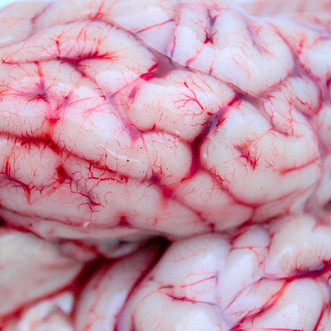 Wirtualny mikroskop. Mózg